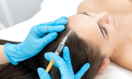 PRP-for-Hair-Restoration_-Aftercare-Supplements-Topical-Treatments