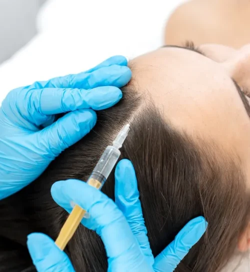 PRP-for-Hair-Restoration_-Aftercare-Supplements-Topical-Treatments